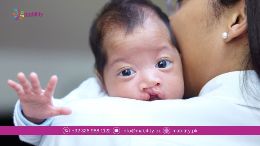 cleft lip and cleft palate