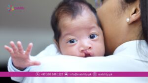 cleft lip and cleft palate