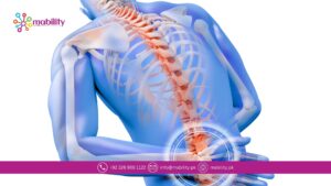 Back Pain Treatment in Lahore