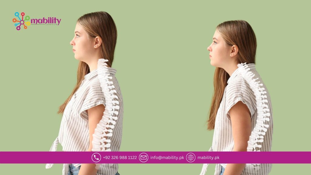Poor Posture Treatment in Lahore